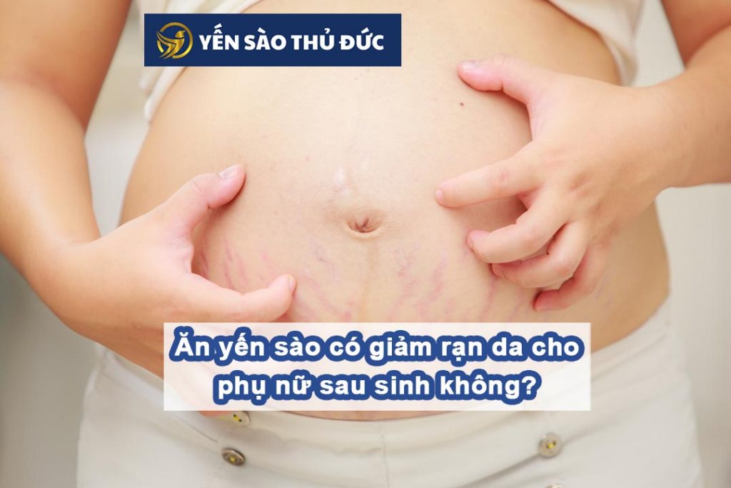 Ăn yến sào có giảm rạn da cho phụ nữ sau sinh không?