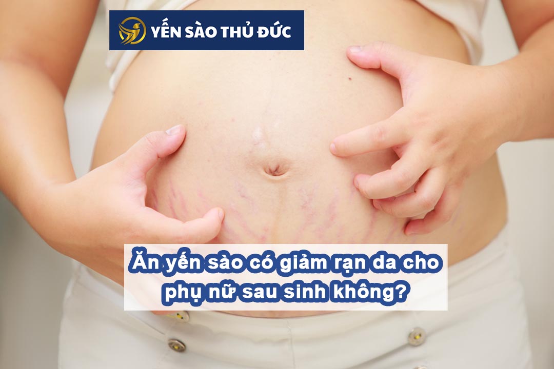 Ăn yến sào có giảm rạn da cho phụ nữ sau sinh không?